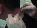 Nape Surface Weaving by Flip