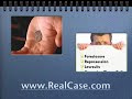 Debt Consolidation Program And Help On Bad Credit Lenders Debt Consolidation Program And Help On Bad Credit Lenders