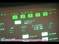 Contact A-Scan Biometry for Cataract Surgery
