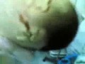 Deformacja 4