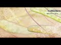 \"Apoptosis\" by Drew Berry