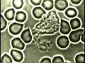 Blood Composition(leukocytes.attack)Ataque de un leucocito