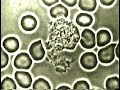 Blood CompositionleukocytesattackAtaque de un leucocito