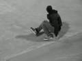 Dogtown Limping
