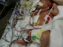 Lex Surgery 7 Days old