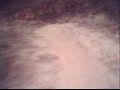 Trialera rossell�
