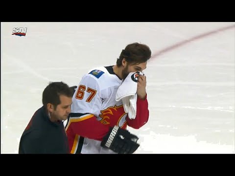 Video: Flames' Frolik takes a puck to the face, leaves game