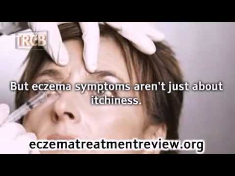 how to bandage eczema