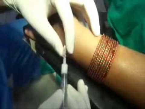 how to relieve wrist ganglion pain