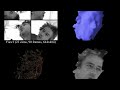 Dense 3D Motion Capture from Synchronized Video Streams