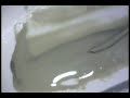 EZ-Fill Cement on GP point EZ-Fill Cement on GP point