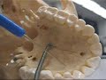 Parts of the Skull