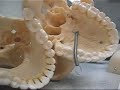 Parts-of-the-Skull