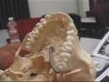 Parts of the Skull
