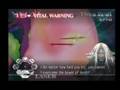videos de Trauma Center Second Opinion X1 - No Stabilizer