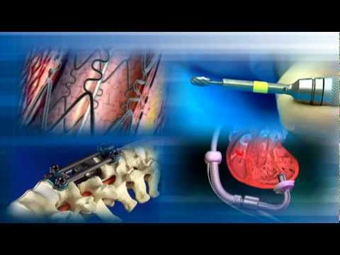 medical equipment - Most medical device inventions start out as a single great idea, but how does that idea become a marketed medical device? This video provides a brief overvie...