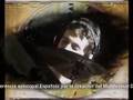 LUIS ALFREDO DIAZ-VH PARTE I