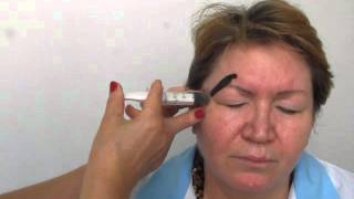 Лечение заболеваний глаз пиявками.