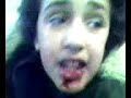 Some 1 after getting beat up Some 1 after getting beat up