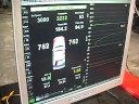 Turbo Optra / Forenza gets a retune and more boost!