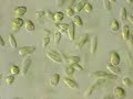 DBWeep Dinoflagellates 1000x DBWeep Dinoflagellates 1000x