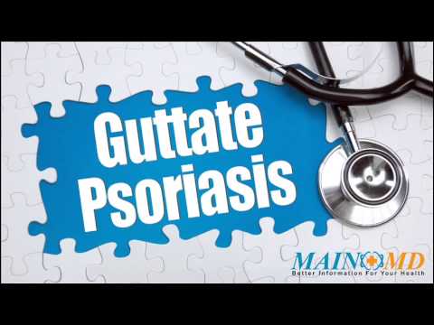 how to treat guttate psoriasis