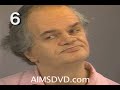 Tardive Dyskinesia Tardive Dyskinesia