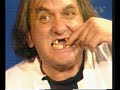 Malnar: Braco - zubić