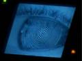 Ortho-K - Night Time Contact Lenses - INVENT [BroadbandTV]