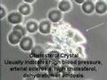 Dr Sandra Cabot's Live Blood Analysis - Victoria Taylor ND