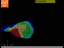 Griding - DTM - Land Surveying Software Griding - DTM - Land Surveying Software