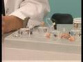 sudden hearing loss, treatments for sudden hearing loss