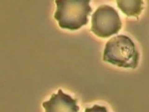Malaria TV