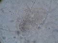 Ciliate sweeping up bacteria
