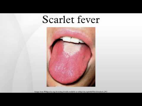 how to cure antistreptolysin o