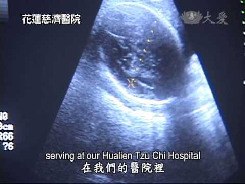 how to relieve suffering