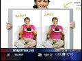 WeightView on KARE - January 5, 2008