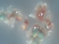 Plaques on a concave slide with 2 drops normal saline added. Magnification is 60xStrange plaques made of numerous 
