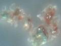 Morgellons Nano plaques attempting to reunify. 60x