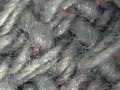 Dust Mites Dust Mites