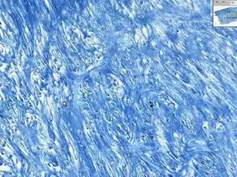 Cartílago - Una Lágrima Cartílago - Una Lágrima