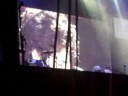 Nick Jonas Diabetes Speech Burning Up Tour Sacramento