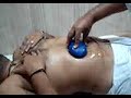 ULTRACONTOUR Lipo going on - Comfortable patient sleeping-1
