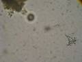 Ameba desnuda