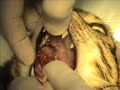 Gingivitis linfoplasmocitaria felina