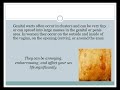 Home treatment for Genital Warts - Wart Removal