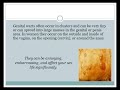 Home treatment for Genital Warts - Wart Removal
