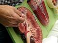 videos de NCC renal lab practical