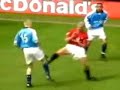 Sport Bloopers