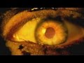 SLAYER - Eyes of The Insane